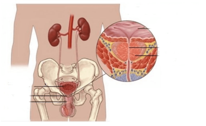 Prostatitis bei Männer