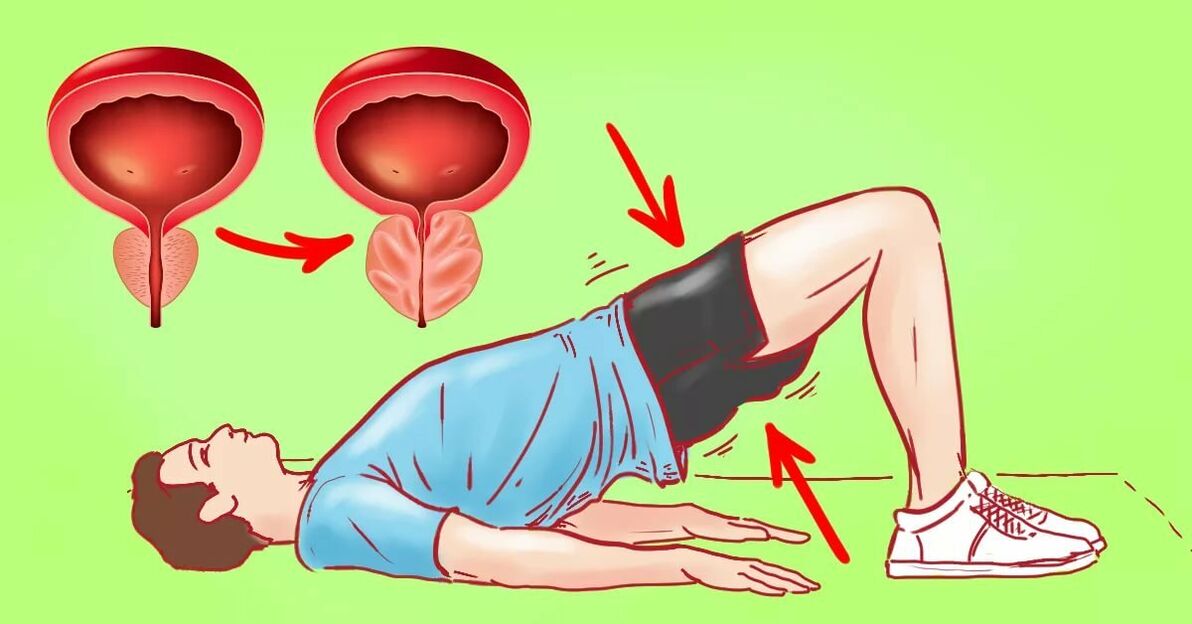 Übungen fir Prostatitis
